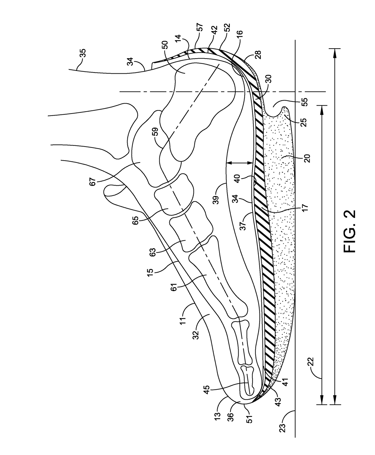 Heelless athletic shoe