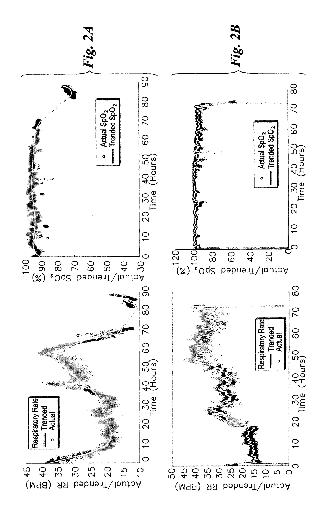 Respiratory stress detection