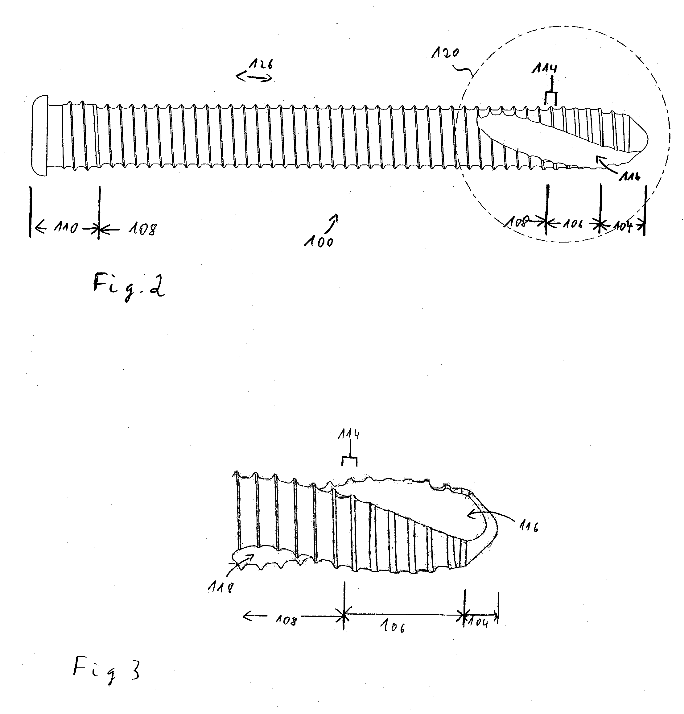 Bone screw and method of manufacturing same