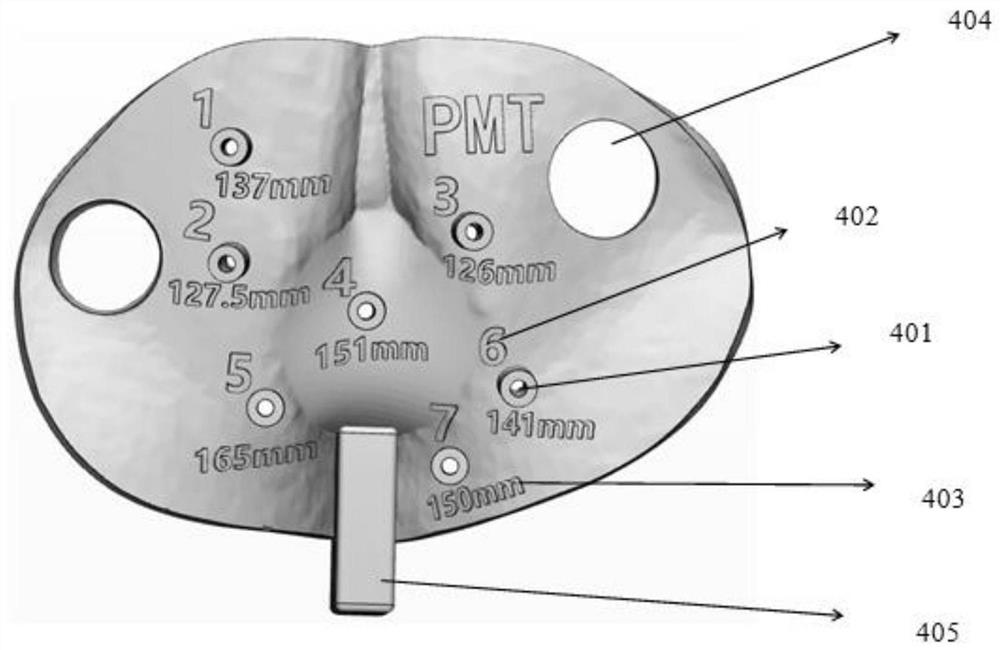 Implantation guide plate design method and implantation guide plate