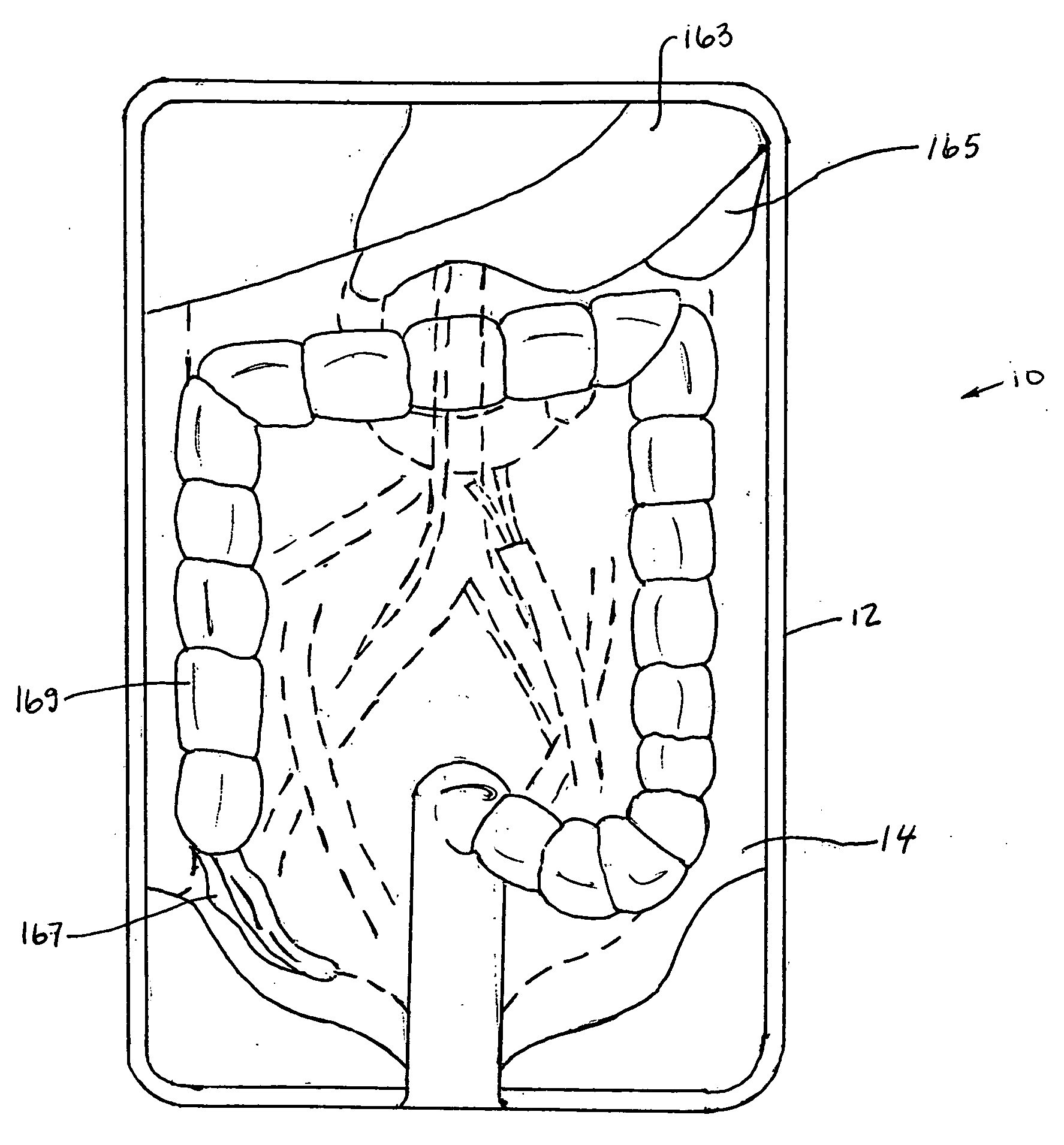 Surgical training aid apparatus