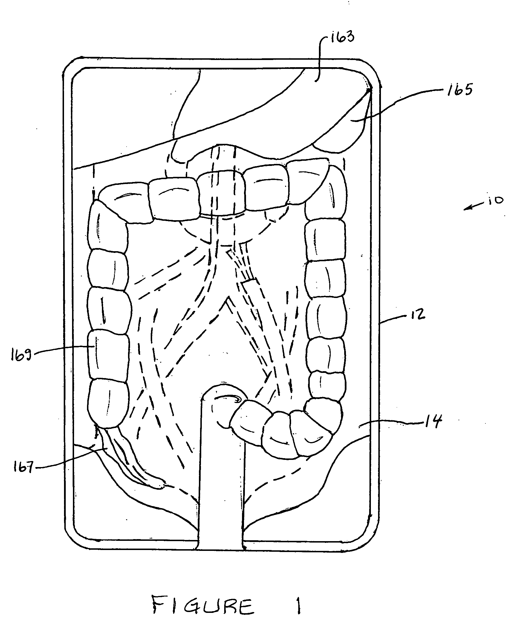 Surgical training aid apparatus