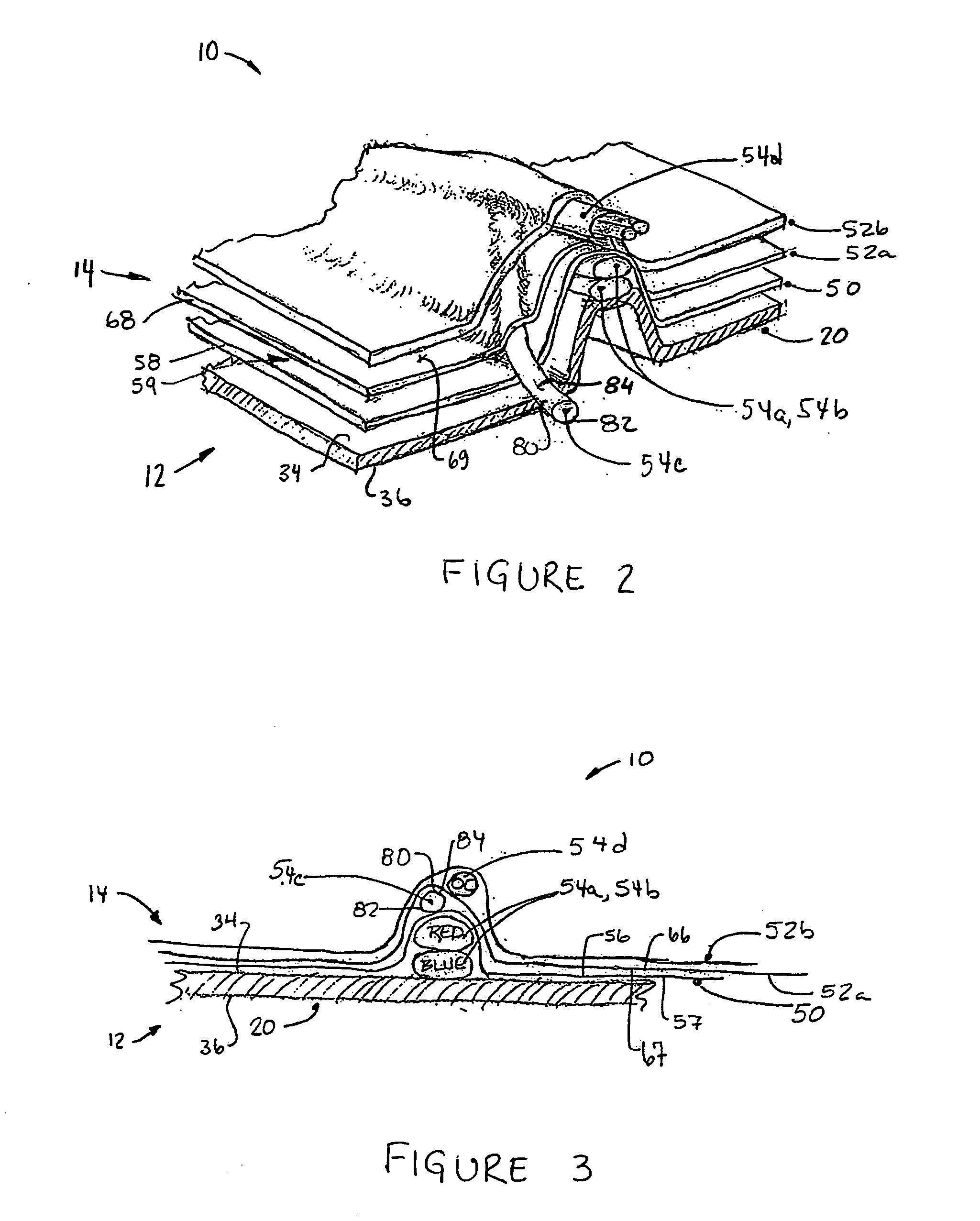 Surgical training aid apparatus