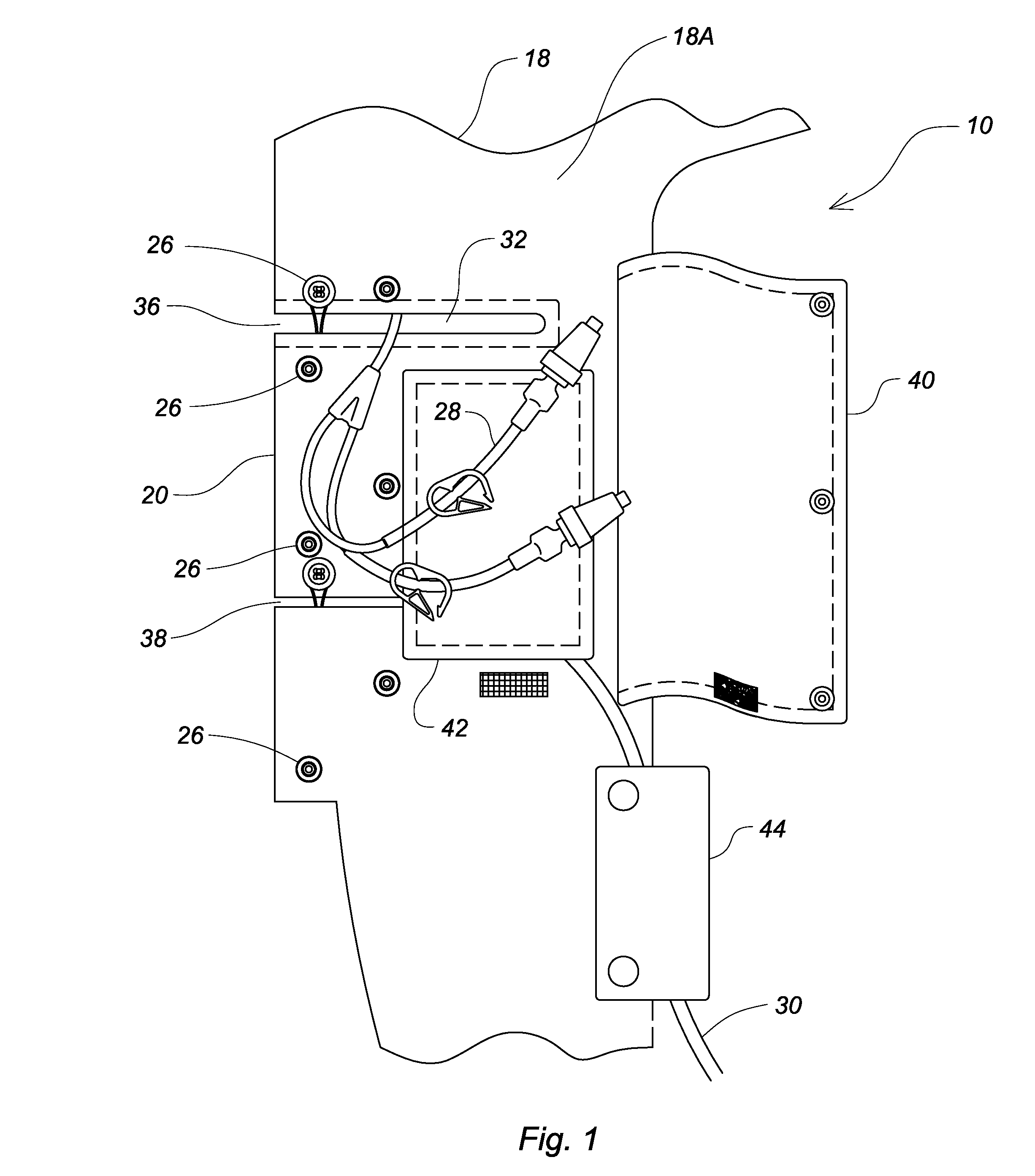 Garment for accommodating intravenous catheters and gastronomy tube