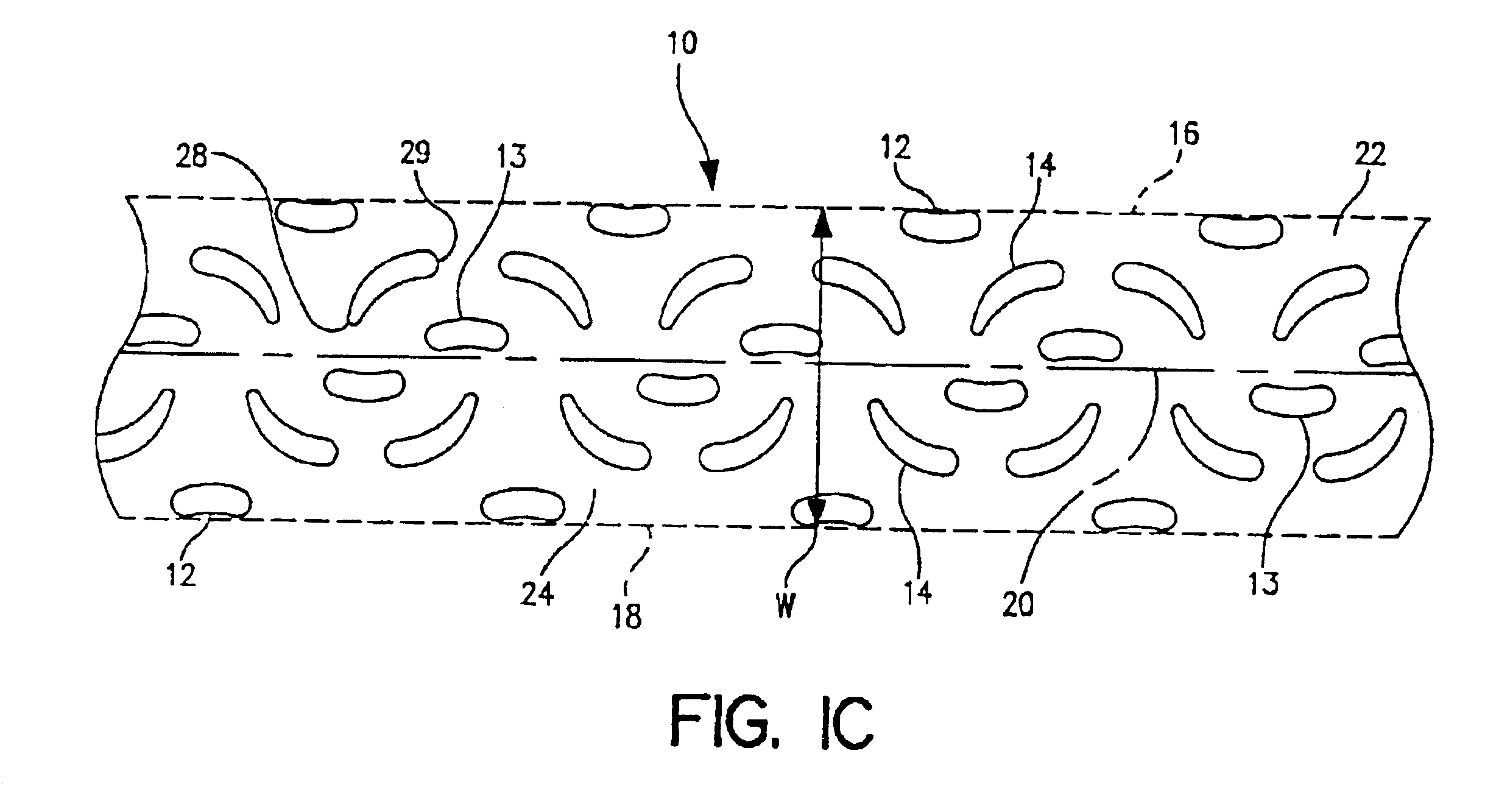 Method of making tear-resistant adhesive/combination bond pattern