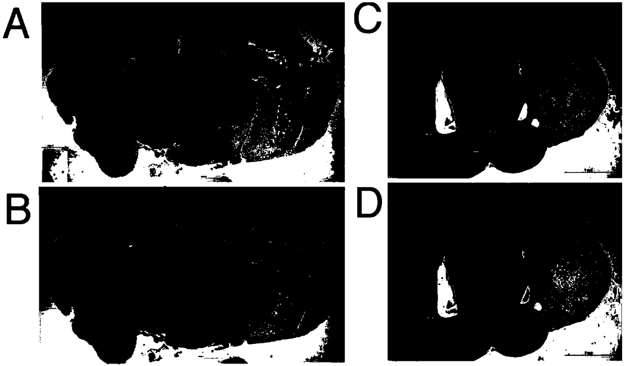 Use of umbilical cord blood regenerated particle and composition thereof in treatment of cerebral degenerative diseases