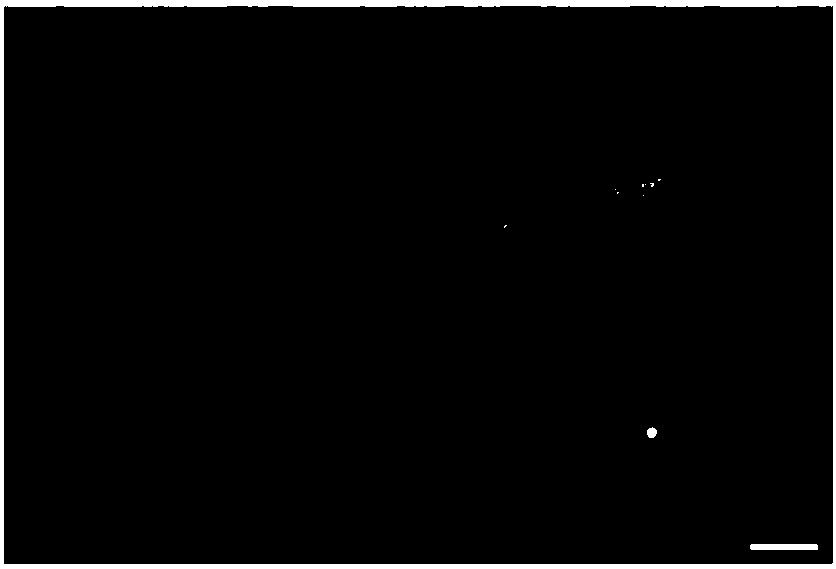 Use of umbilical cord blood regenerated particle and composition thereof in treatment of cerebral degenerative diseases