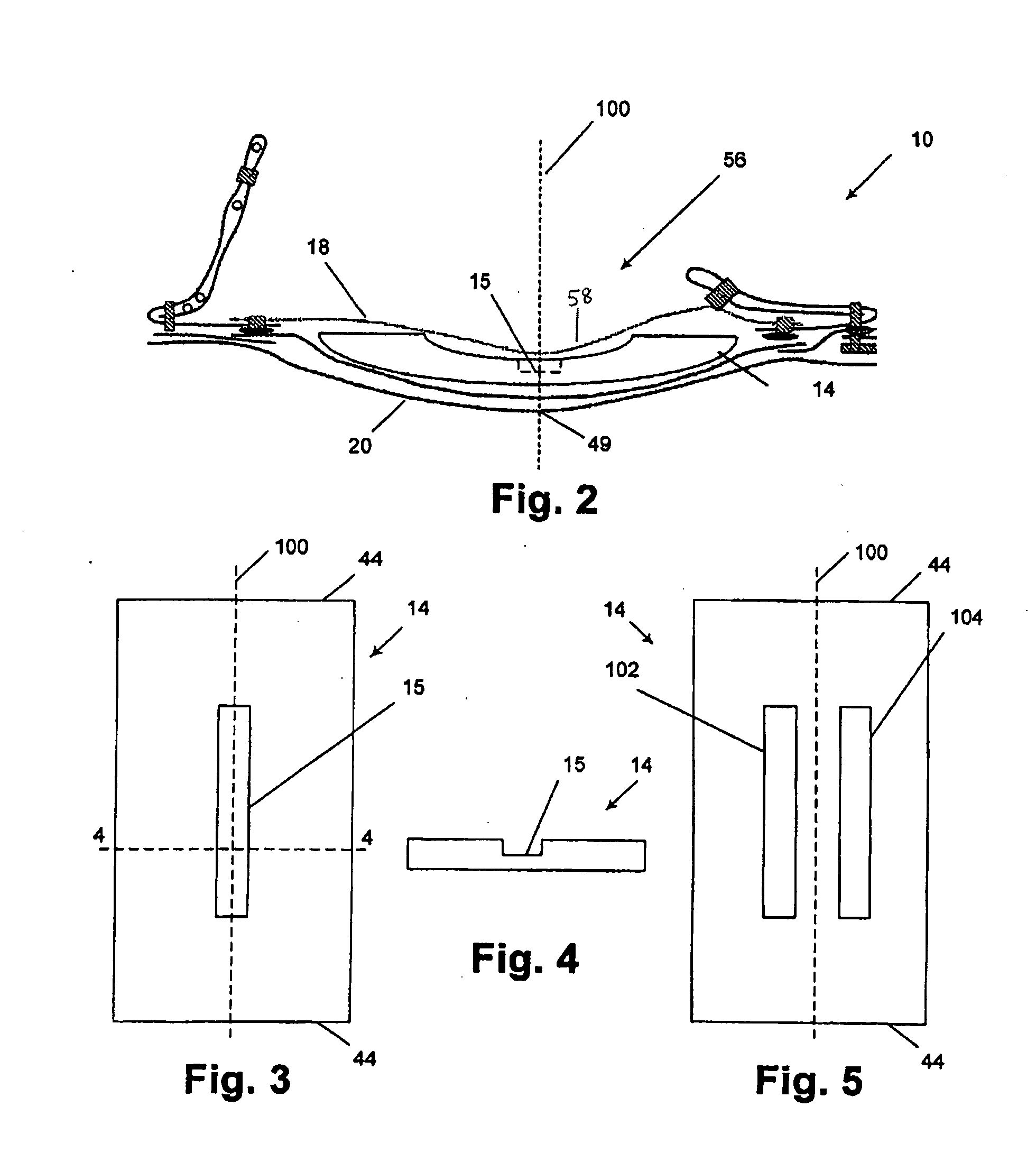 Better Fitting Diaper Or Pant With Absorbent Particulate Polymer Material And Preformed Crotch