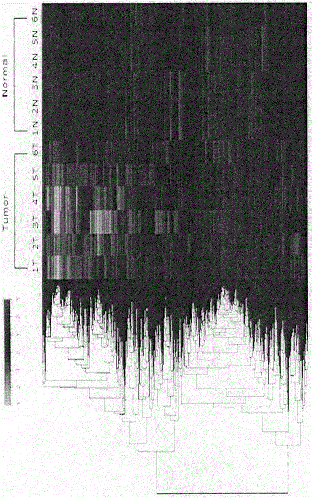 Esophageal carcinoma (EC) diagnosis marker and application method thereof