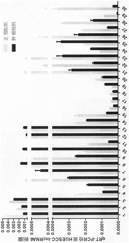 Esophageal carcinoma (EC) diagnosis marker and application method thereof