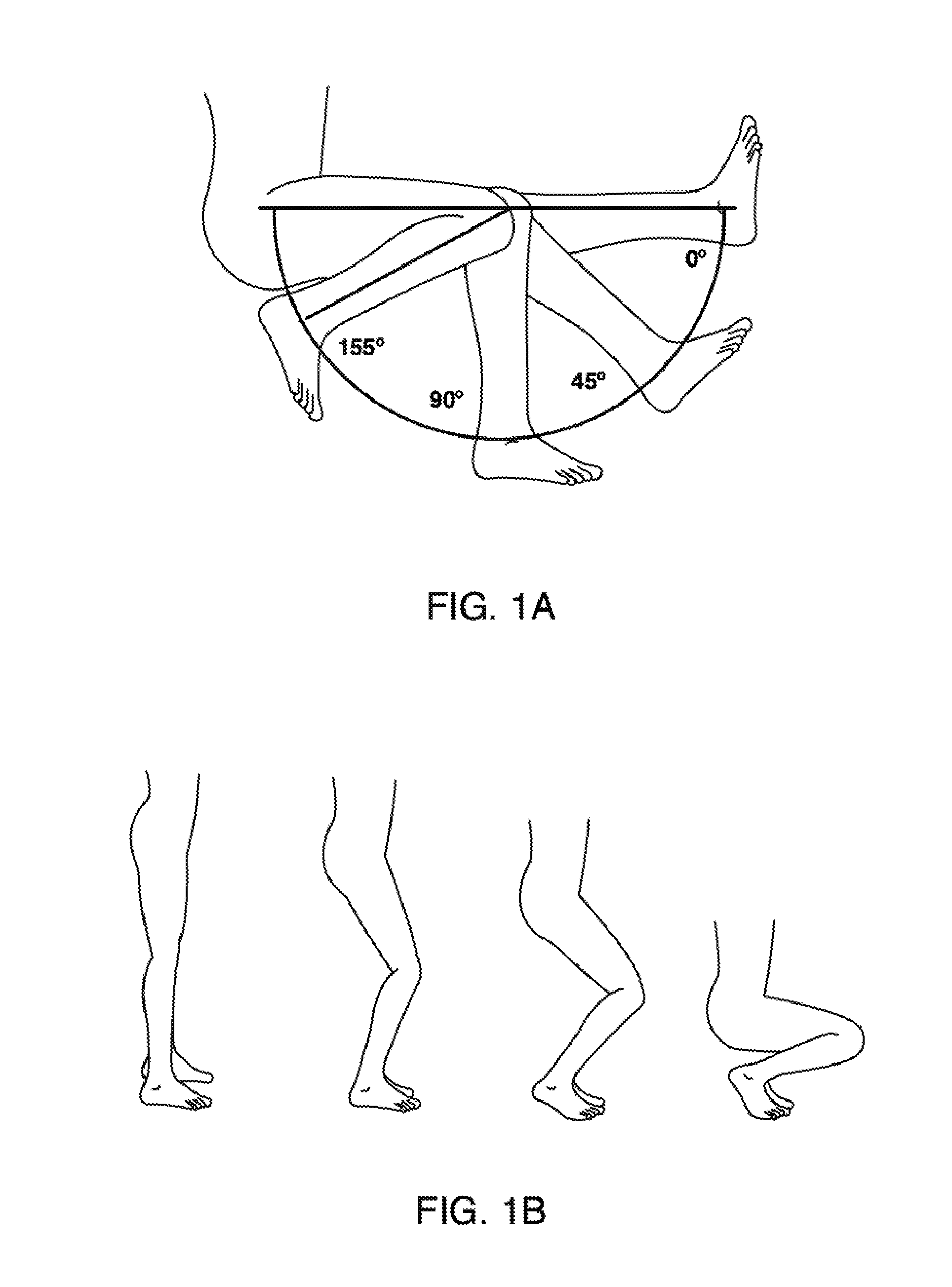 Systems and methods for providing prosthetic components