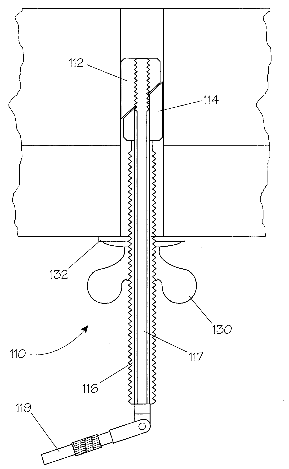 Bench anchor