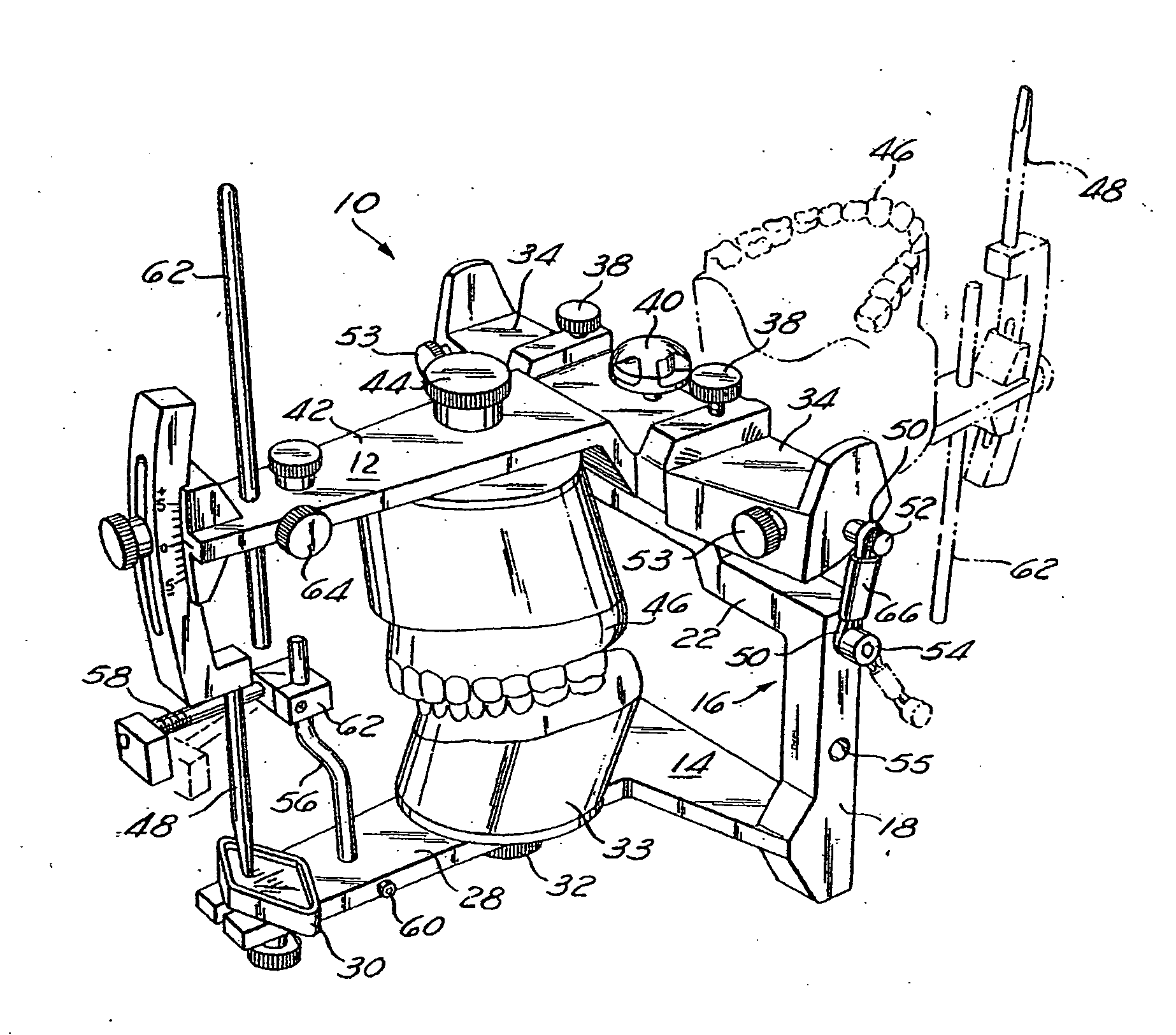 Dental articulator