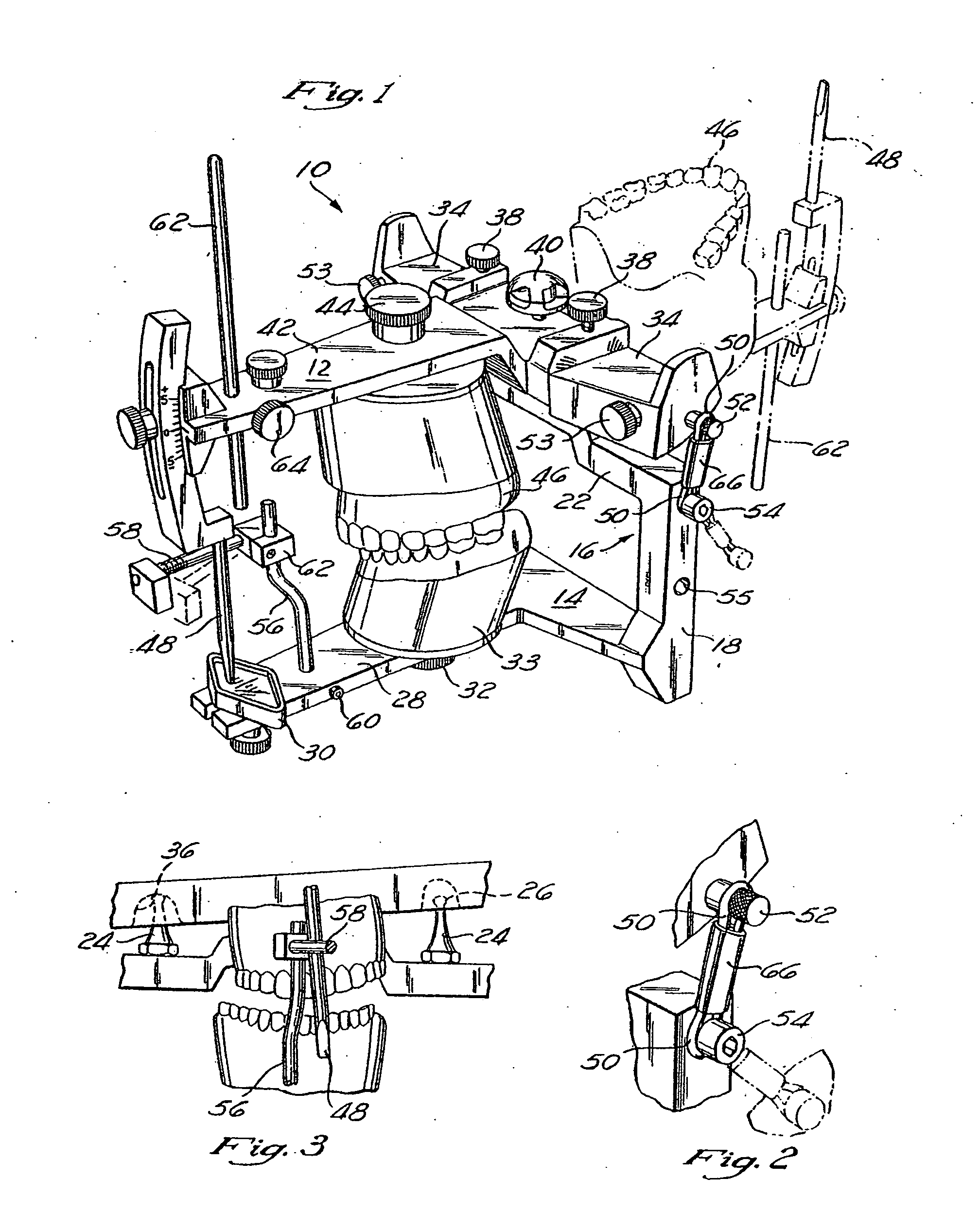 Dental articulator