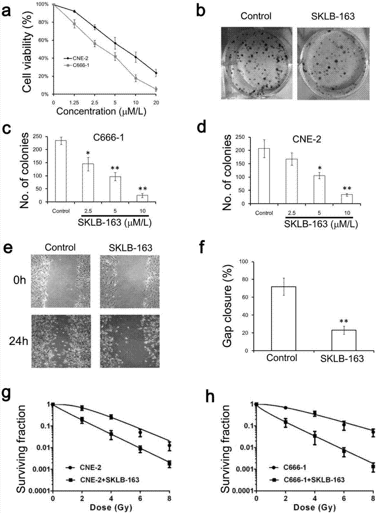 Application of RhoGDI inhibitor to preparation of drugs for treating nasopharynx cancer