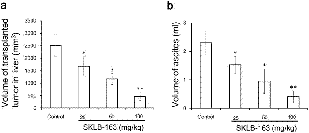 Application of RhoGDI inhibitor to preparation of drugs for treating nasopharynx cancer