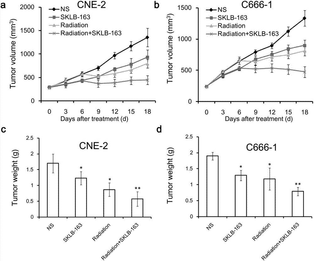 Application of RhoGDI inhibitor to preparation of drugs for treating nasopharynx cancer