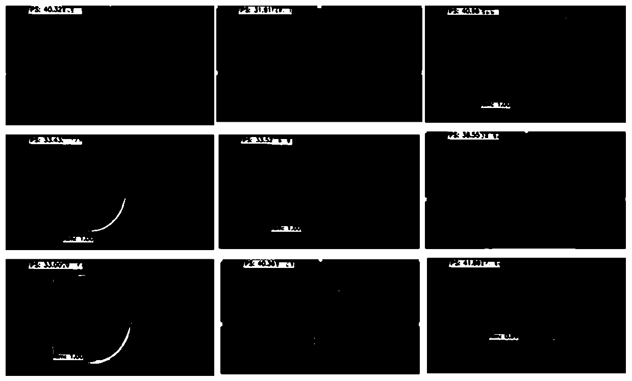 Intelligent detection and early warning method and system for outer envelope in prostate operation