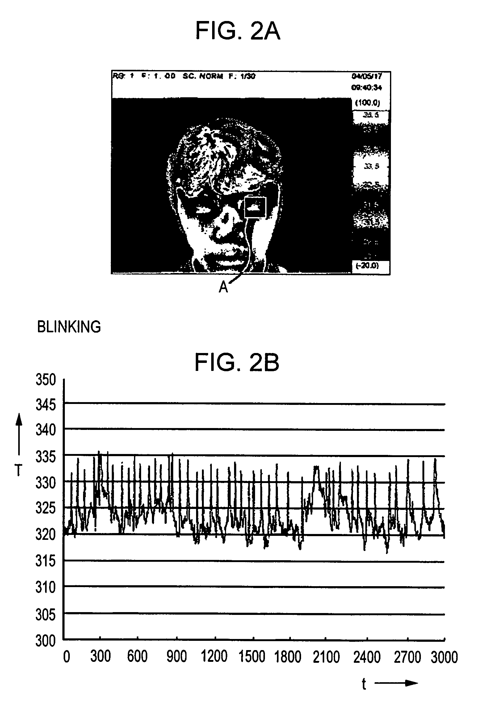 Method and apparatus for processing bio-information