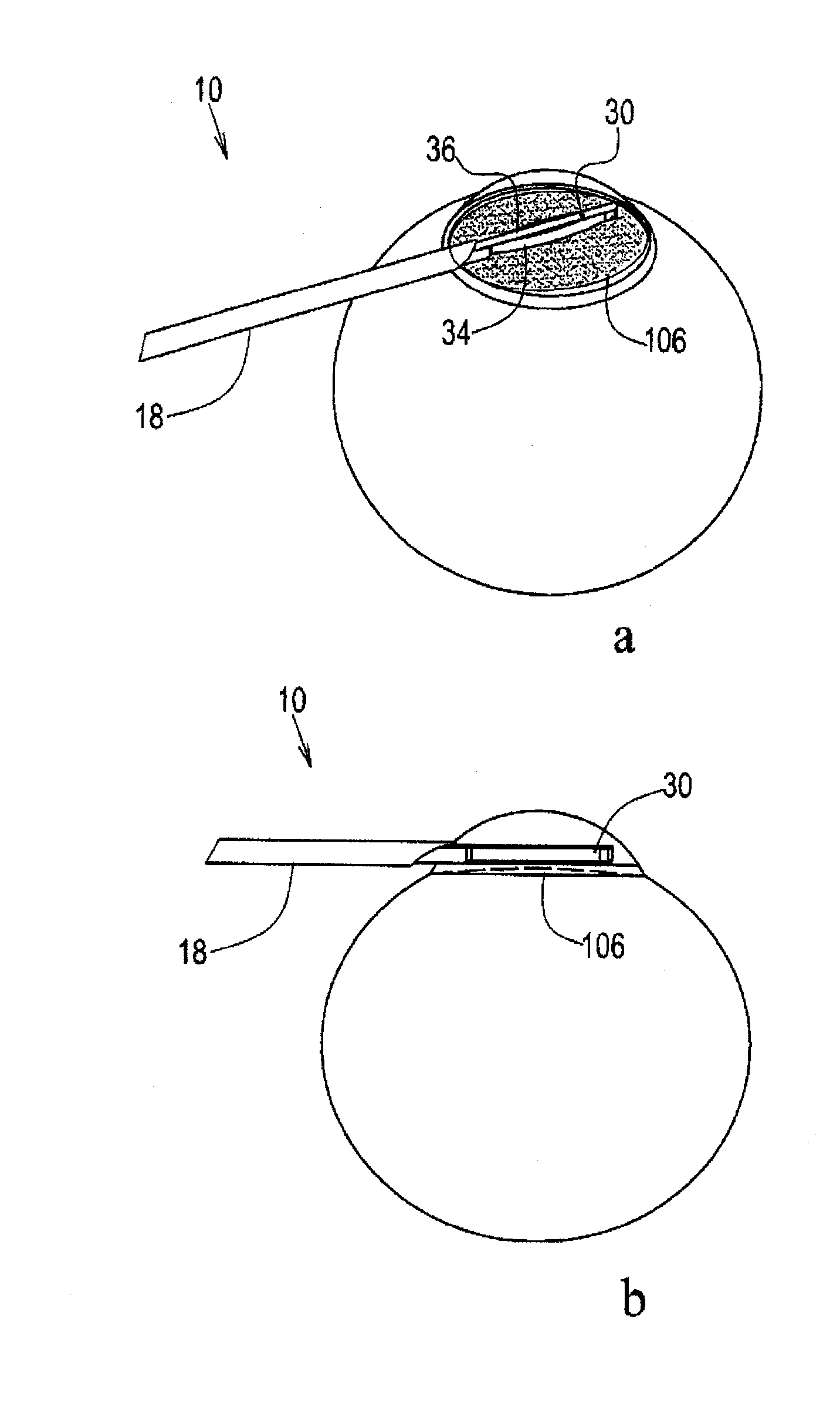 Circular thermal capsulotomy tool and system