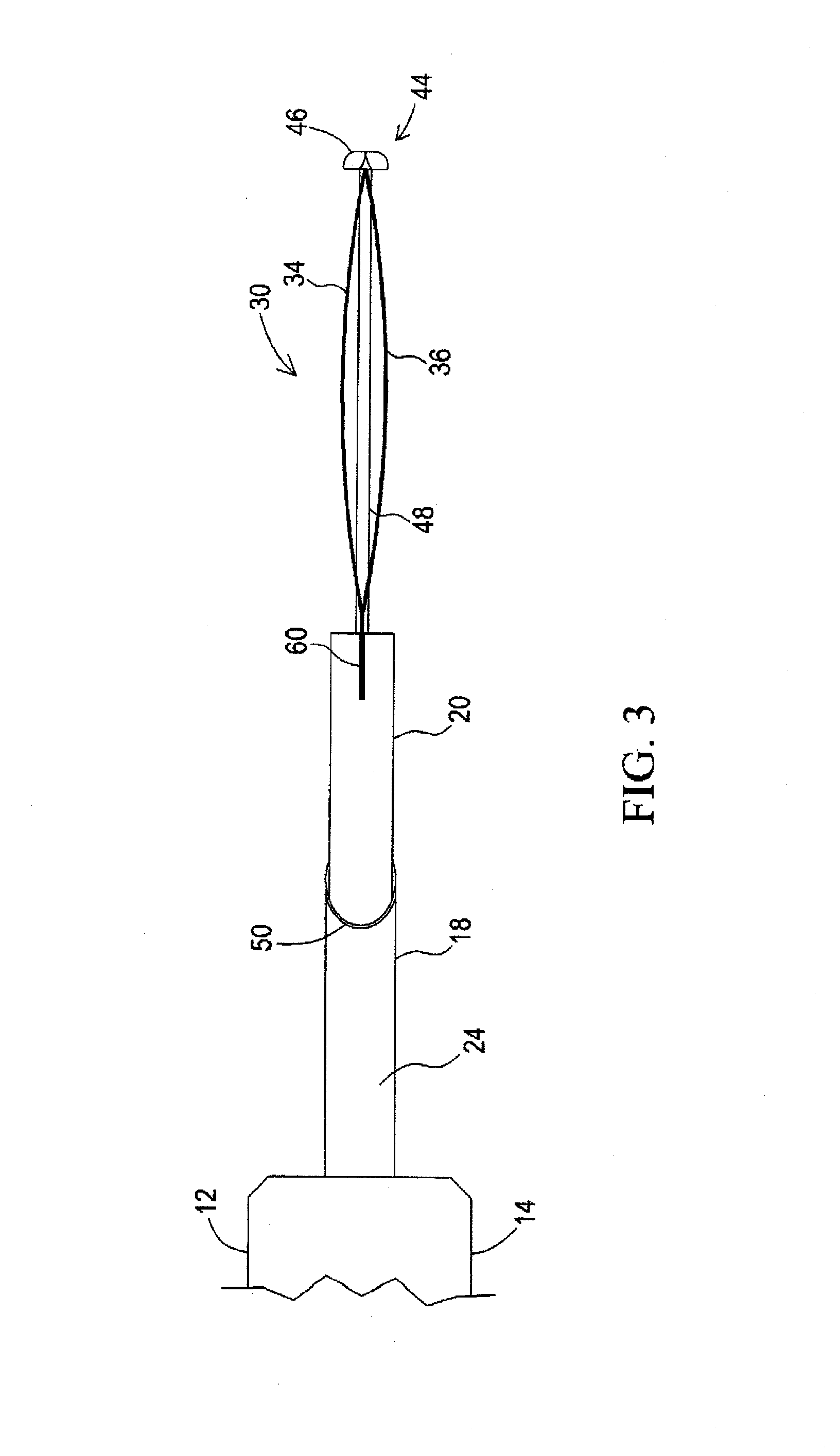 Circular thermal capsulotomy tool and system