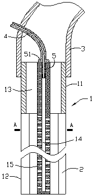 Suction head of aspirator for abdominal operation