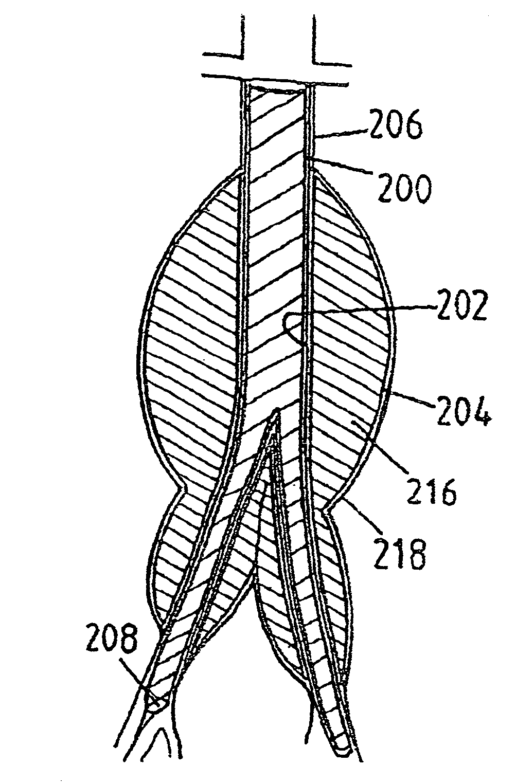 Devices for repairing aneurysms