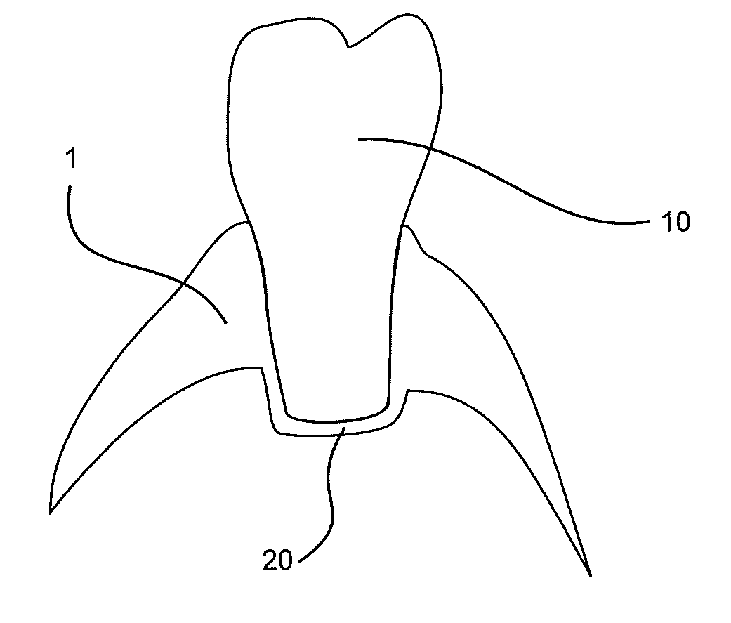 Method for manufacturing a denture