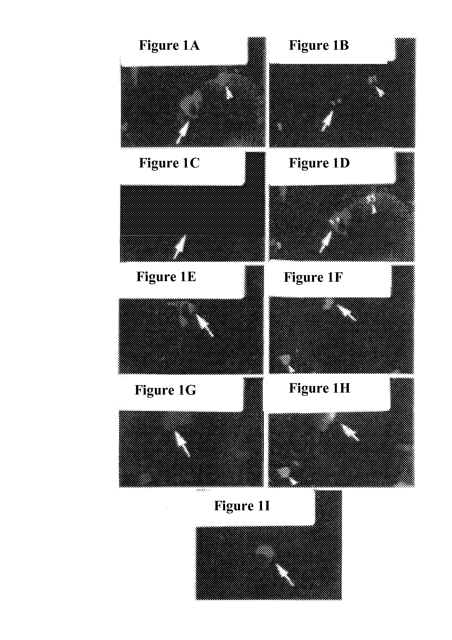 Bone Augmentation Utilizing Muscle-Derived Progenitor Compositions, And Treatments Thereof