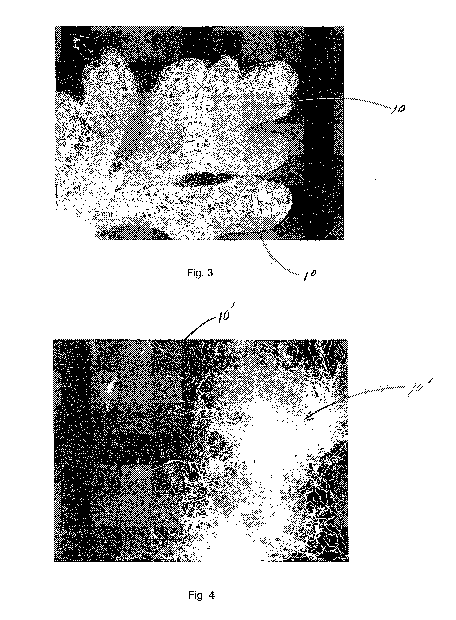 Soft and strong fibrous structures and methods for making same