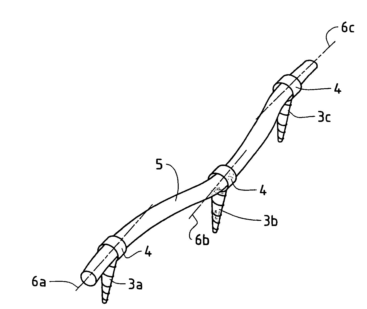 Elastic stabilization system for vertebral columns