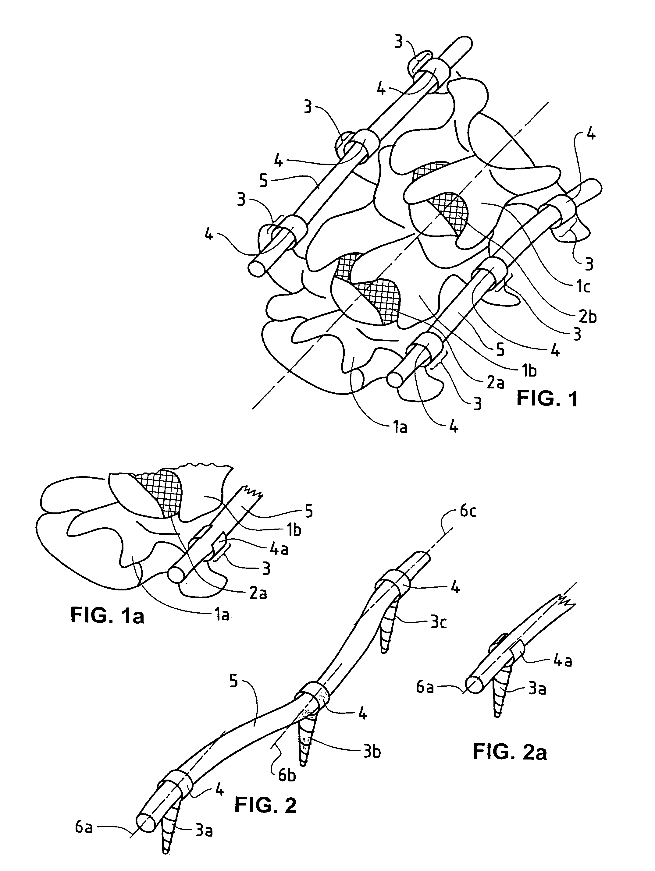 Elastic stabilization system for vertebral columns