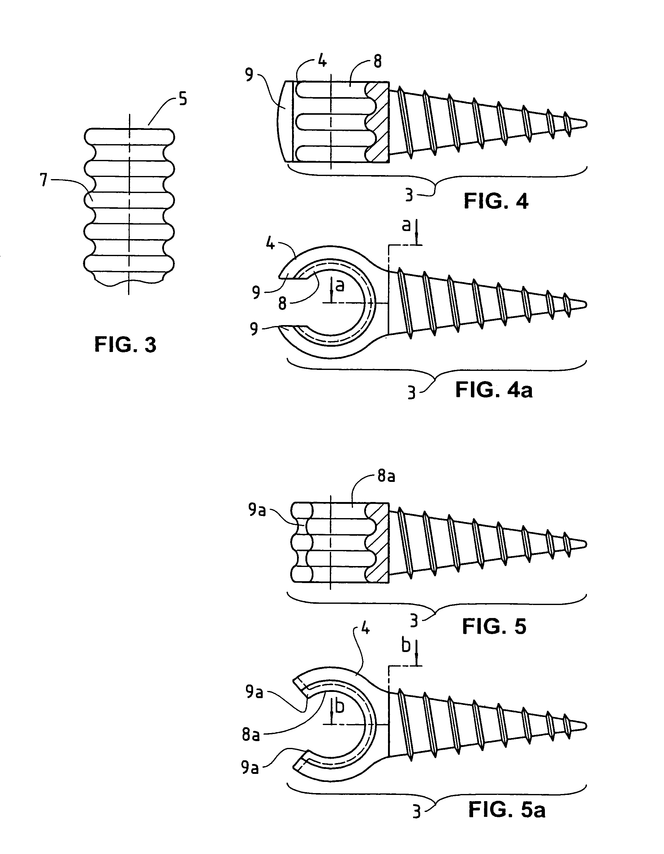 Elastic stabilization system for vertebral columns