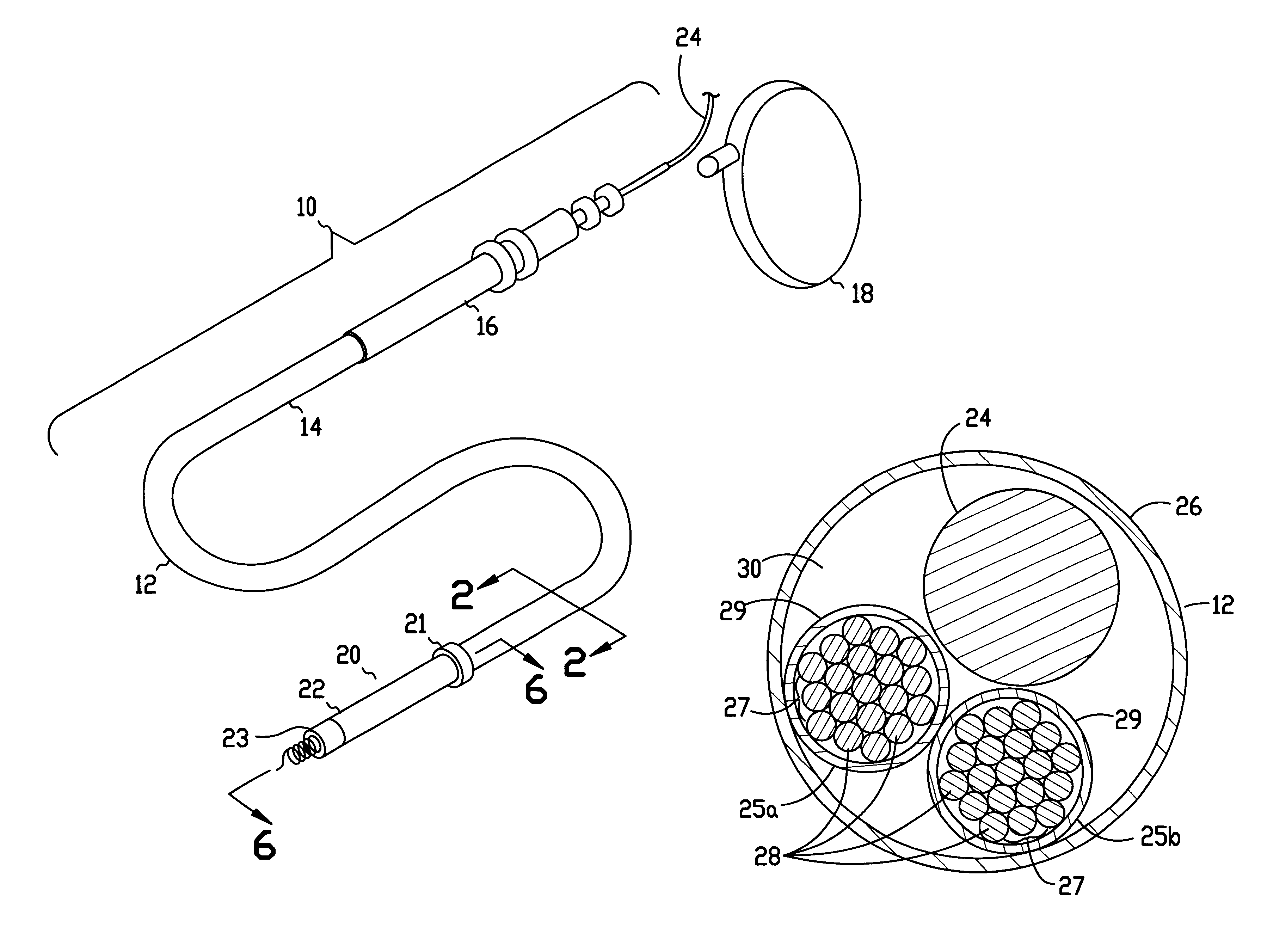 Cardiac lead with minimized inside diameter of sleeve