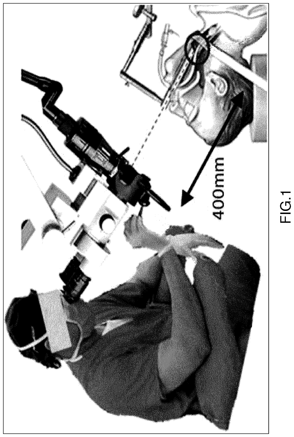 Movement amplifying actuation device