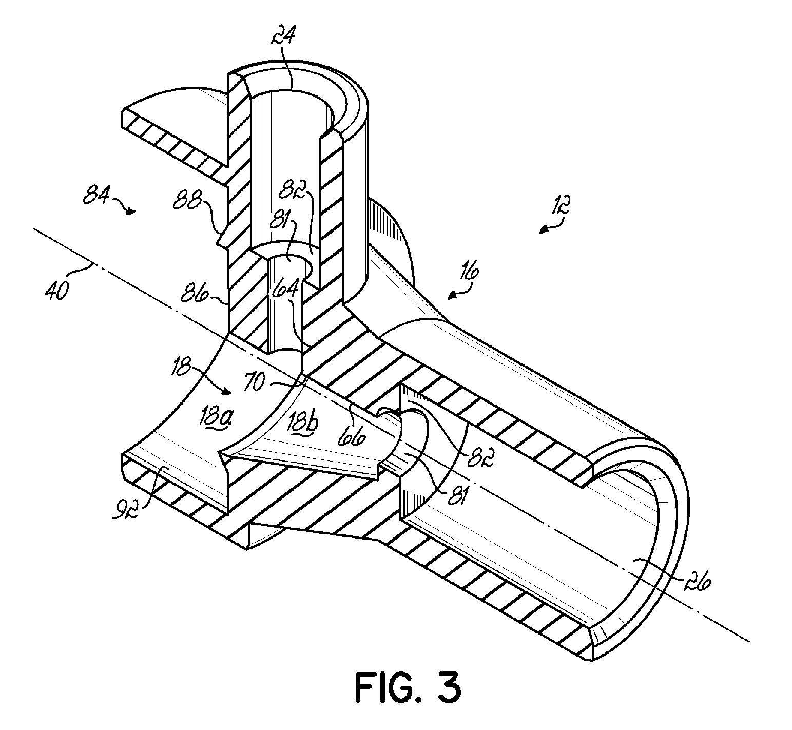 Momentary high pressure valve