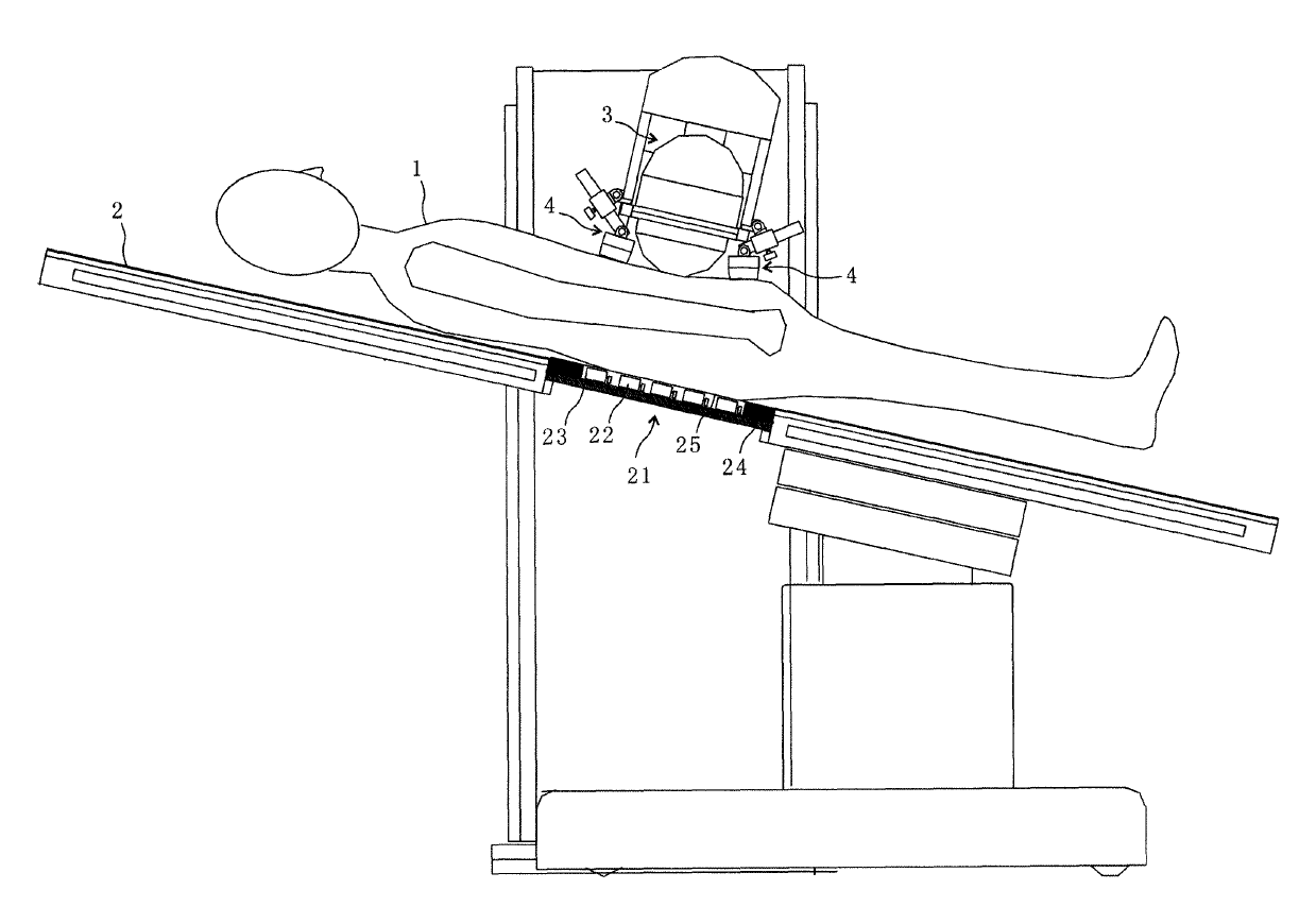 Calculus smashing and removing integrated device