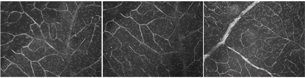 Uses of 7,8-dihydroxyflavone in preparation of drugs for treatment of optic nerve injury