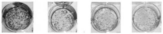 4-amide substituted pyrimidine targeted DDR1 inhibitor as well as preparation and anti-tumor activity application thereof