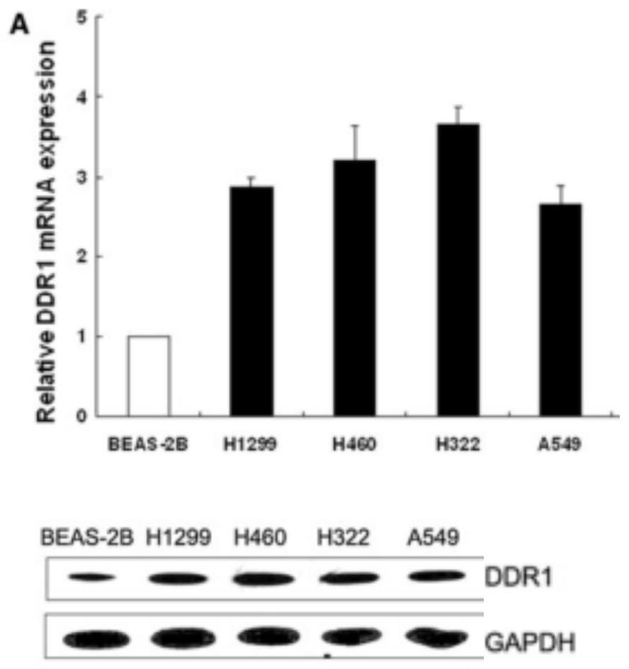 4-amide substituted pyrimidine targeted DDR1 inhibitor as well as preparation and anti-tumor activity application thereof