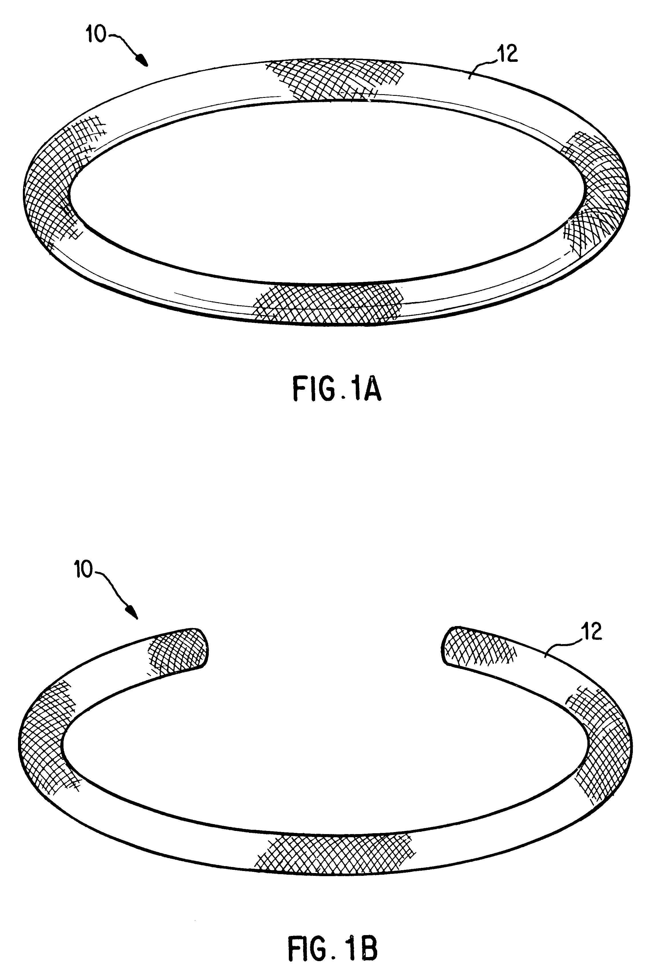 Antimicrobial annuloplasty ring having a biodegradable insert