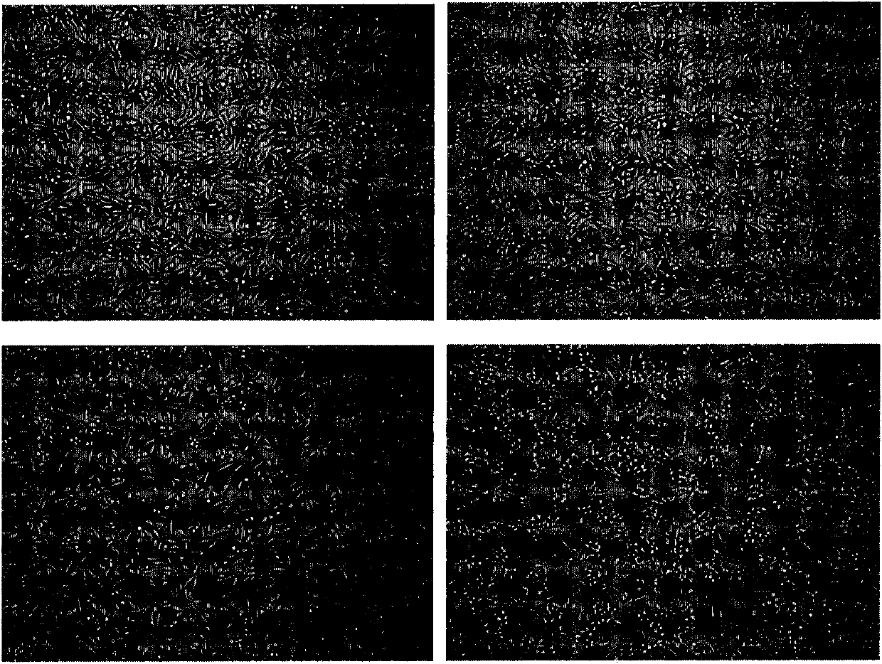 Application of red stilbene and red stilbene polysaccharide in preparing medicament for improvement of learning memory and treatment of Alzheimer disease