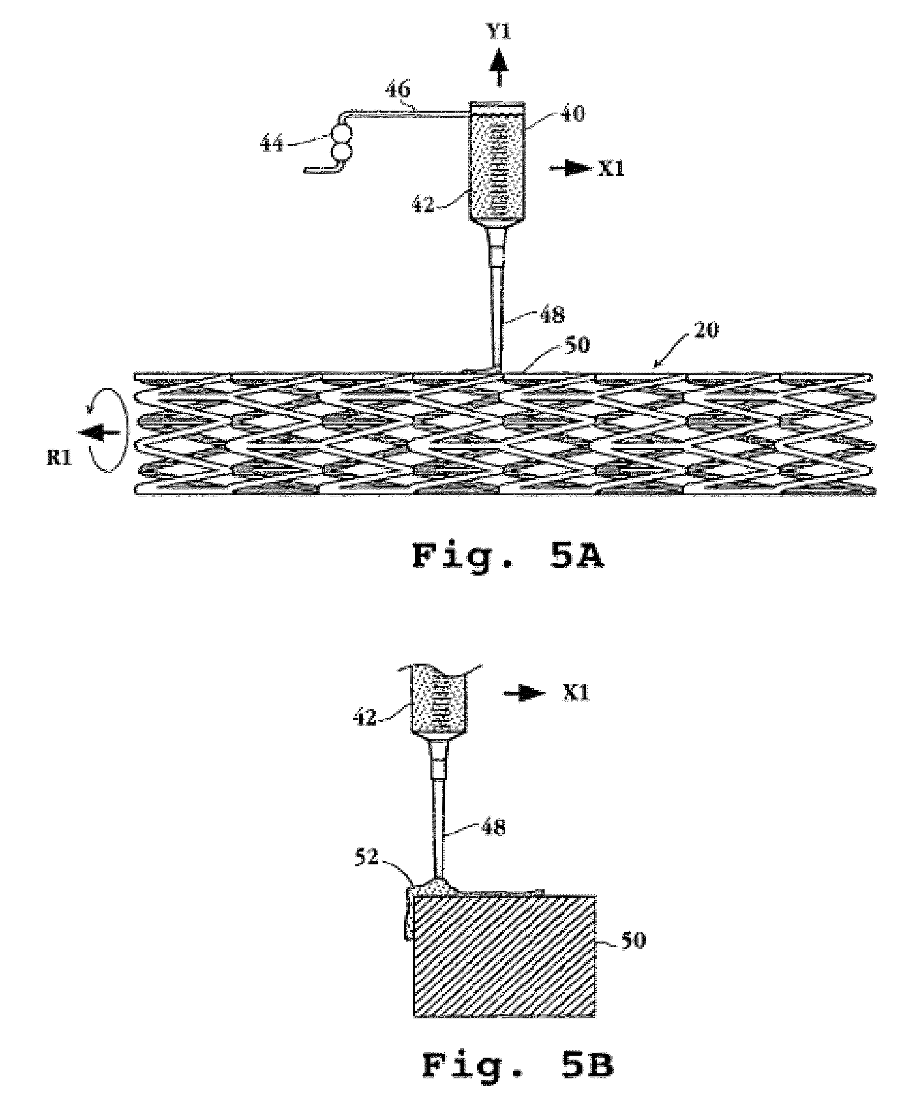 Drug-delivery endovascular stent and method of forming the same