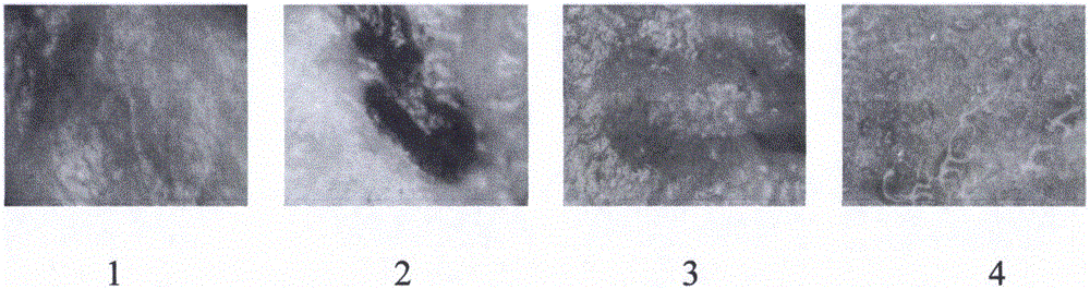 Pharmaceutical composition for treating atherosclerosis and application