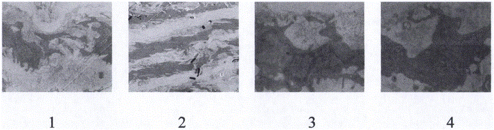 Pharmaceutical composition for treating atherosclerosis and application