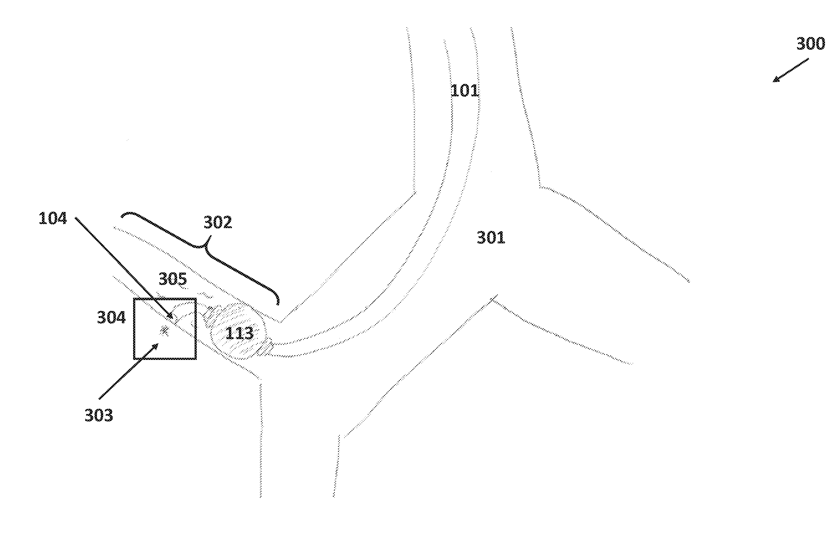 Reusable catheter with disposable balloon attachment and tapered tip