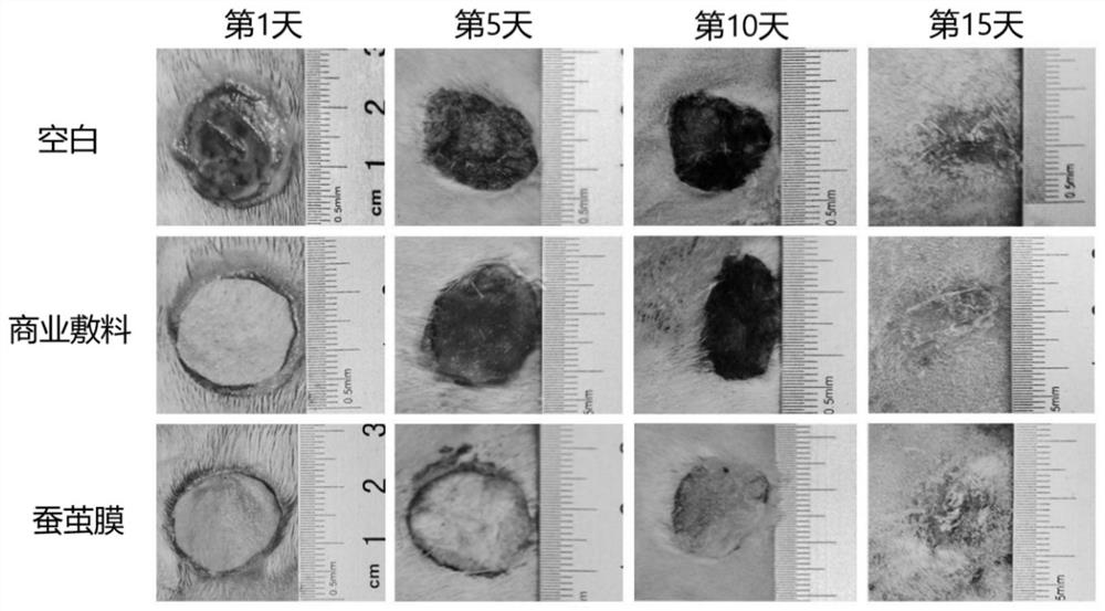 Preparation method of antibacterial silkworm cocoon-based wound dressing