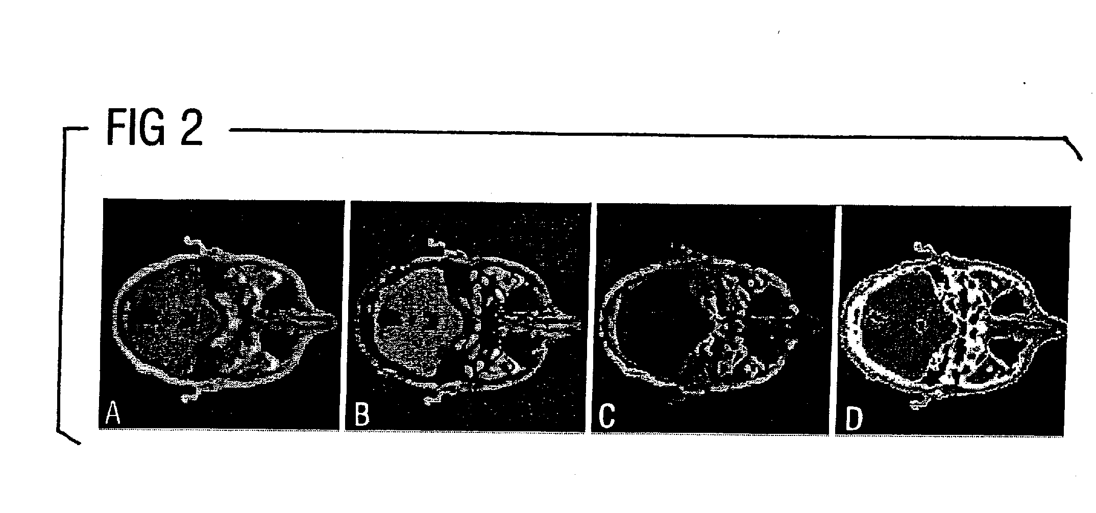 Magnetic resonance method and apparatus for automatically determining objects that attenuate penetrating radiation