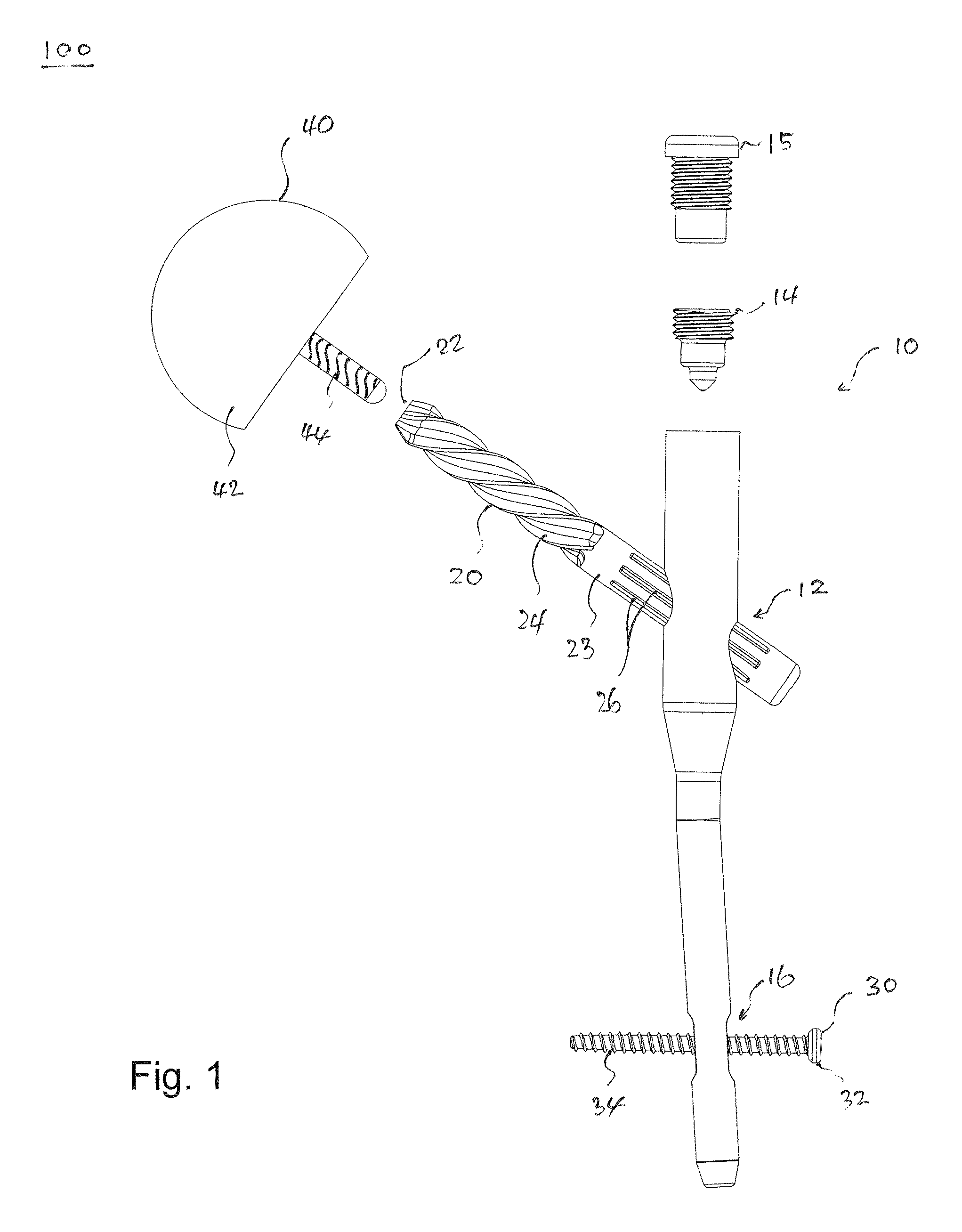 Durable resurfacing hip replacement device