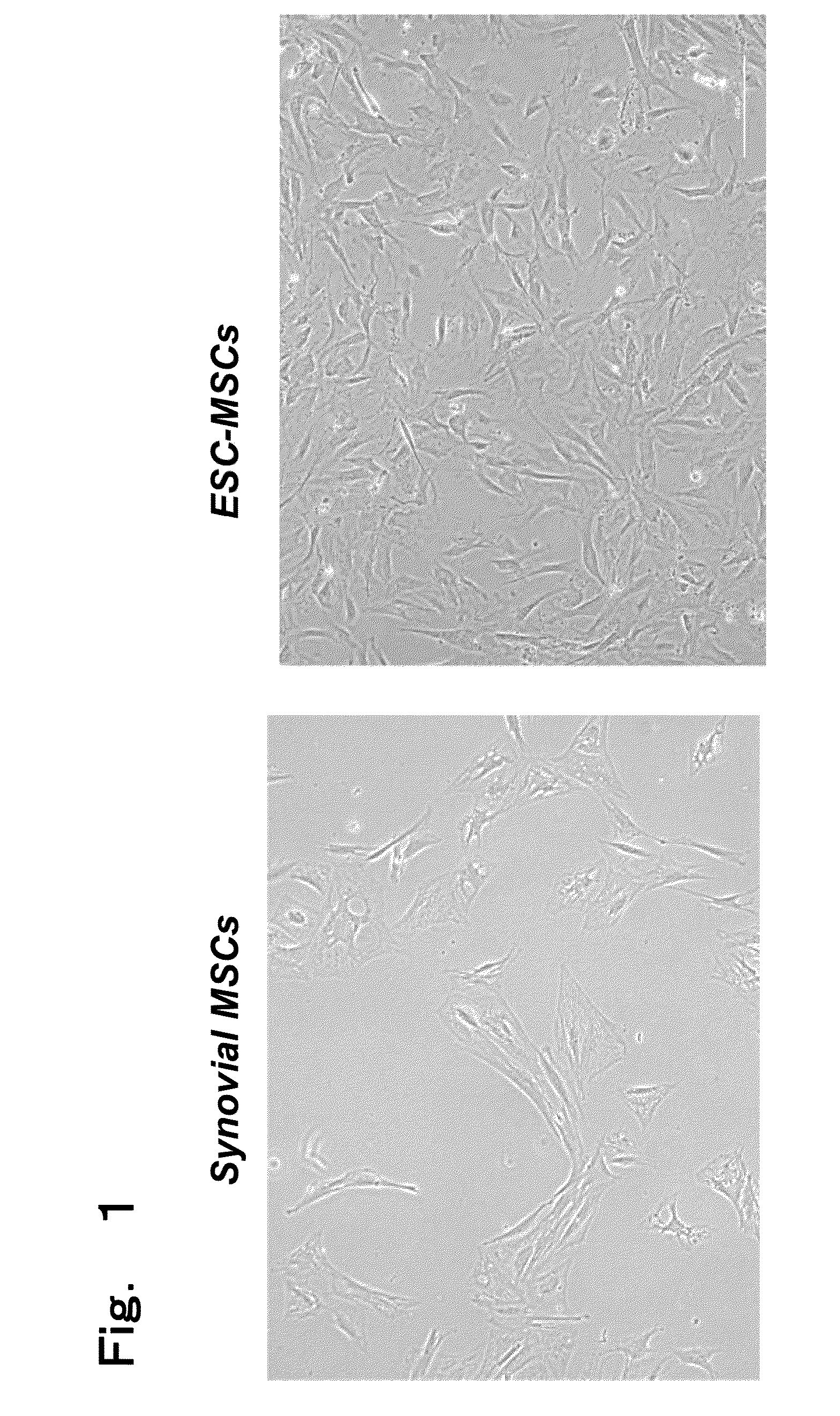 Creation of three-dimensional synthetic tissue from pluripotent stem cell-derived cells, and osteochondral regeneration treatment using said synthetic tissue